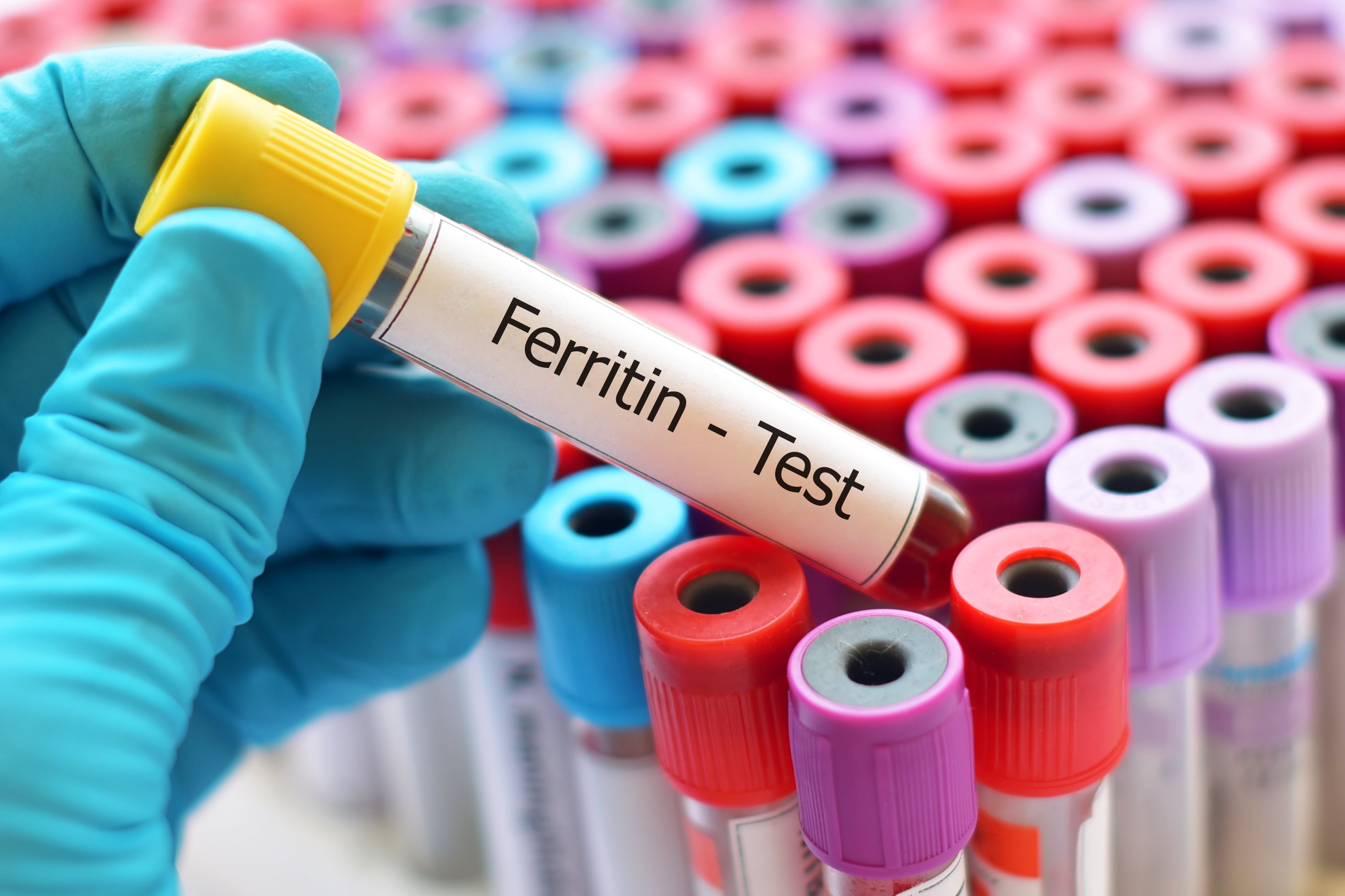 مخزون الحديد (Ferritin)؟ - مختبر رويال الطبي